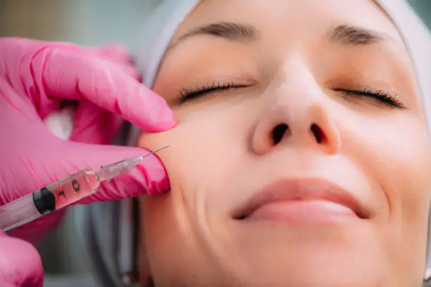 How Do Cheek Fillers Restore Lost Volume?