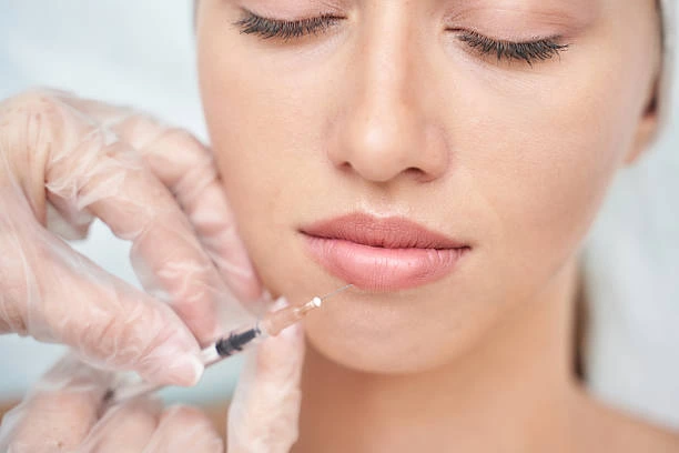 How Do Russian Lip Fillers Improve Lip Symmetry?
