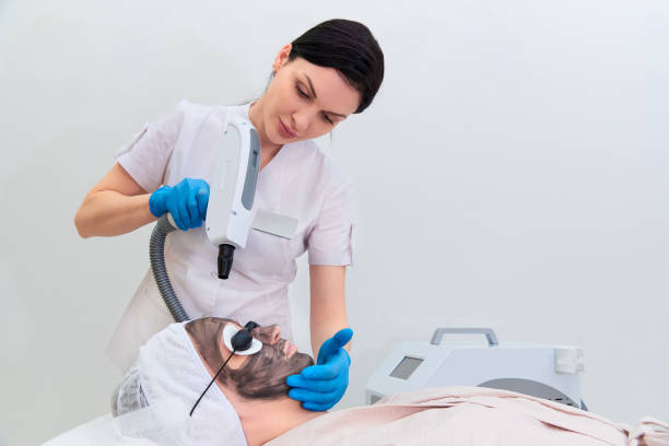 How Does Laser Carbon Peel Clean Deep Skin Pores?