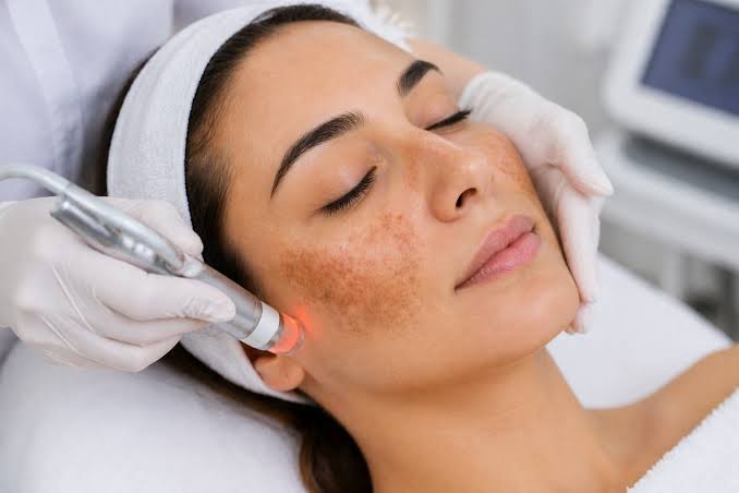 How can Melasma treatment reduce visible skin discoloration?