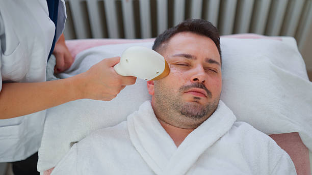 How does Beard Laser Hair Removal support smoother skin