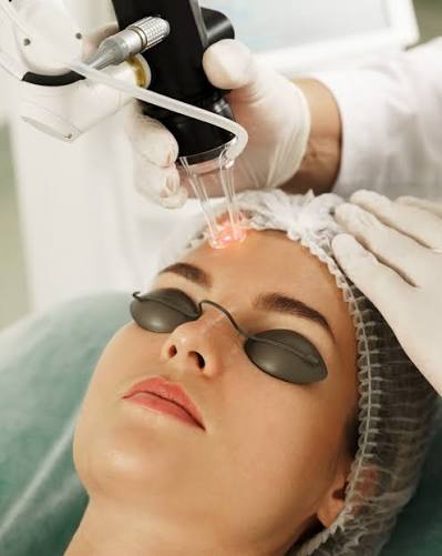 How does Pico laser treatment support clearer-looking skin