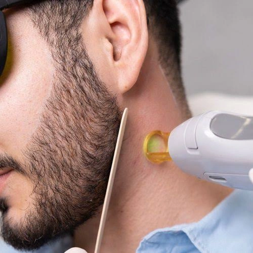 Is Beard Laser Hair Removal Good for Thick Hair