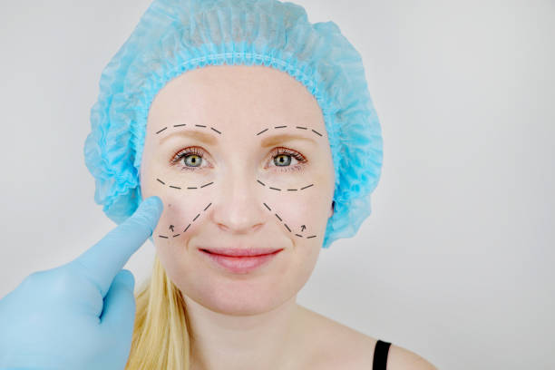 Is Facelift Appropriate for Moderate Facial Aging