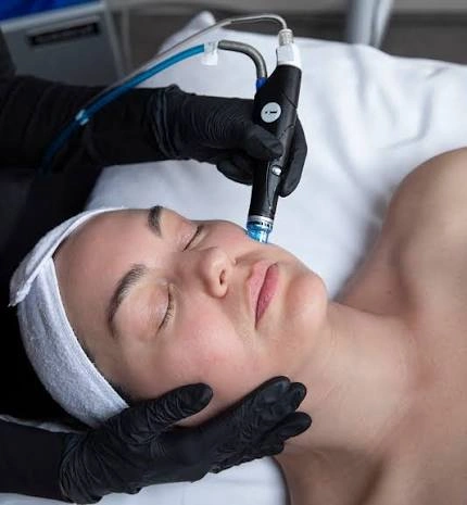 Is Facial Treatment Ideal for Oily Skin?