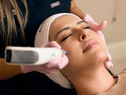 Is Melasma Treatment effective for facial discoloration