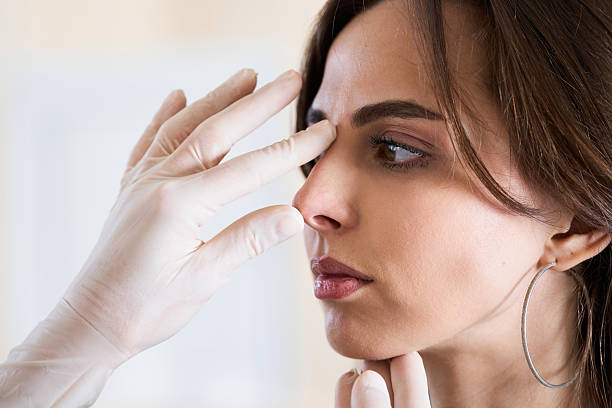 Is Rhinoplasty right for subtle nose shape changes