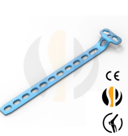 How Buttress Plates Help Stabilize Complex Fractures