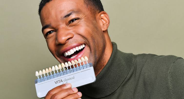 What Patients Should Know About Veneer Materials and Treatment