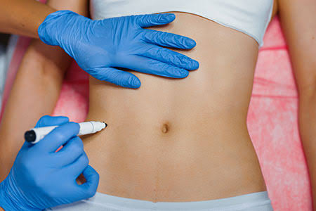 What Is the Process of Body Fillers?