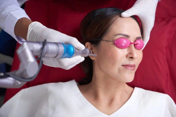What Makes Pico Laser Treatment Target Age Spots?