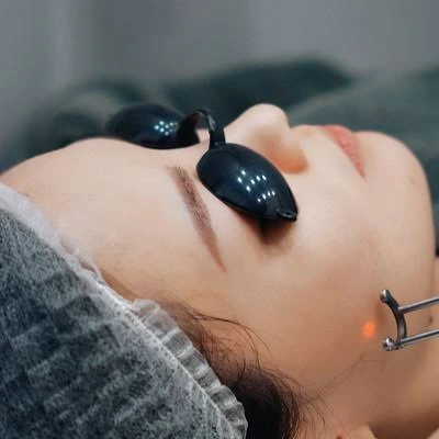 What Results Can Pico Laser Treatment Provide?