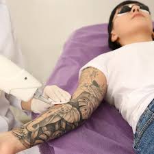 What can Laser tattoo removal do for unwanted tattoos?