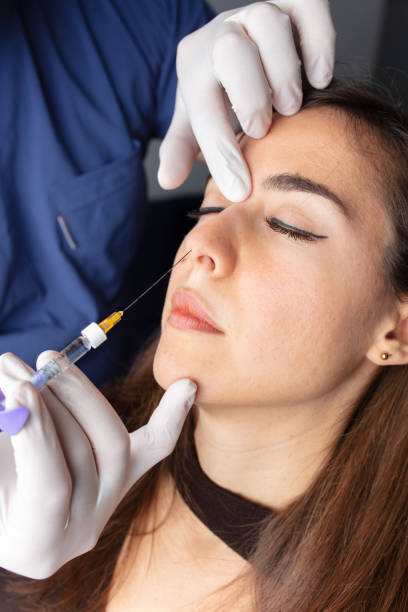 What can Nose Fillers commonly improve in nose shape?