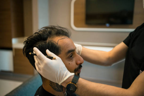 What should you know before choosing Hair transplant treatment?