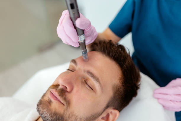 What skin concerns can Microneedling treatment address?
