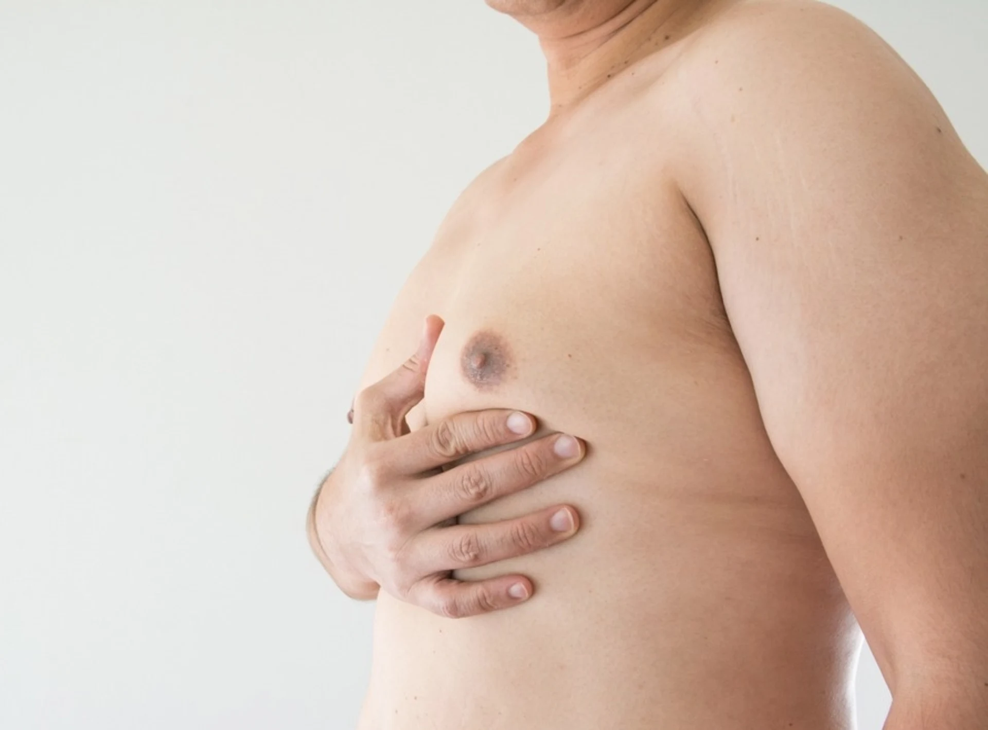 Gynecomastia Surgery Cost