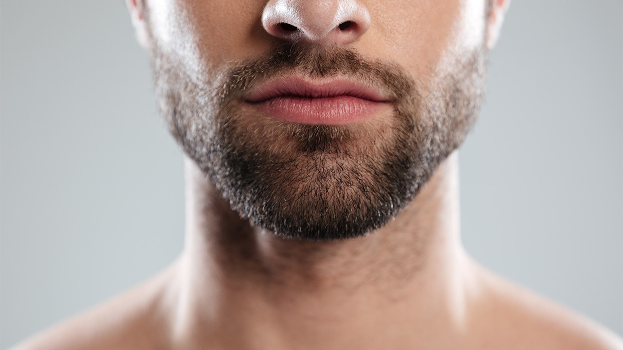 Understanding Natural Graft Placement in Beard Hair Transplant in Dubai