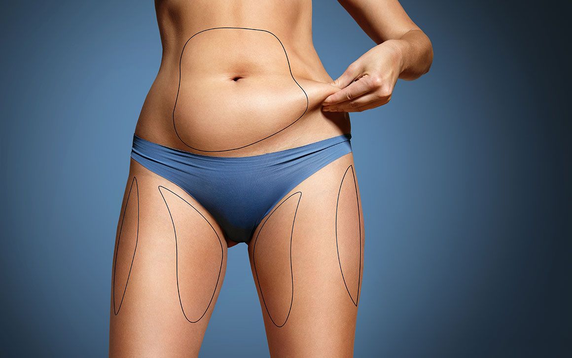 Top Clinics Setting Standards for Liposuction Uae
