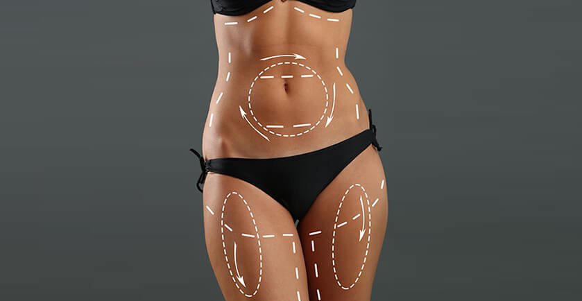 Top Clinics Offering Luxury Liposuction Uae Experiences