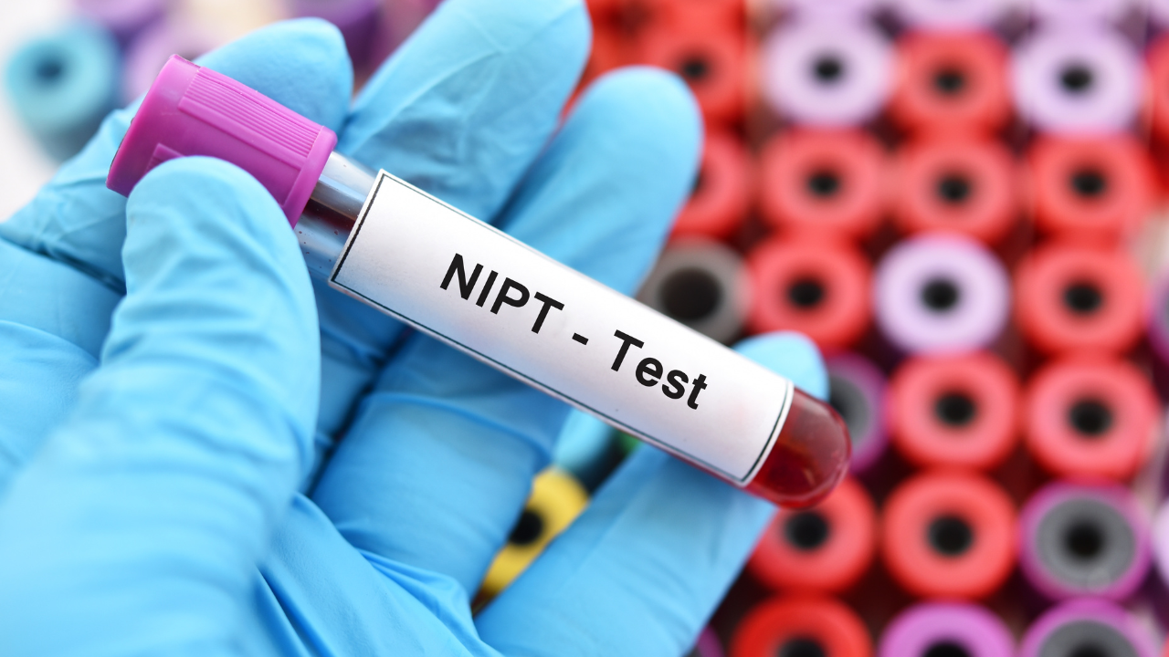 NIPT Test: A Complete Guide to Non-Invasive Prenatal Testing