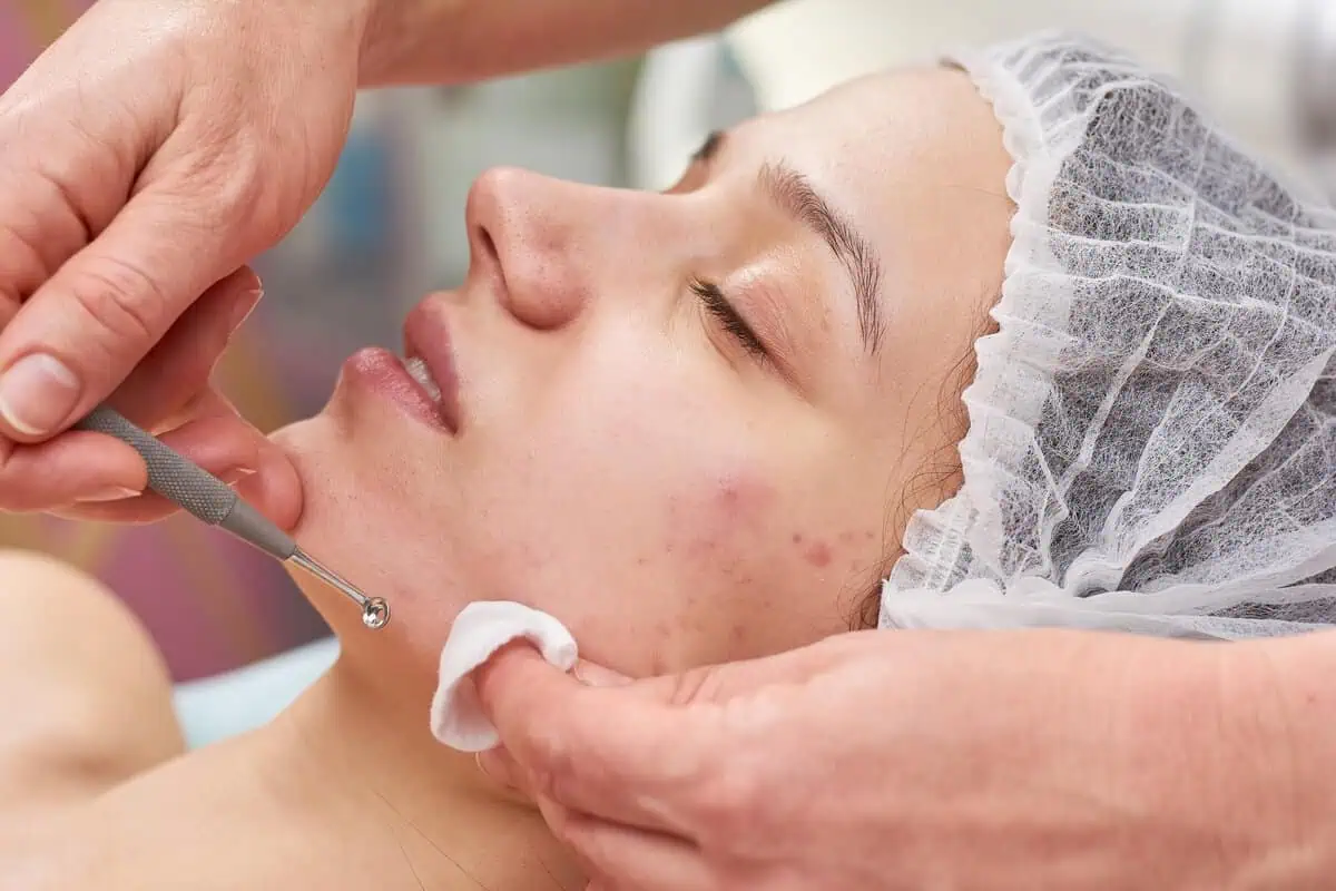 Which Skincare Treatments Are Best for Your Skin Type?