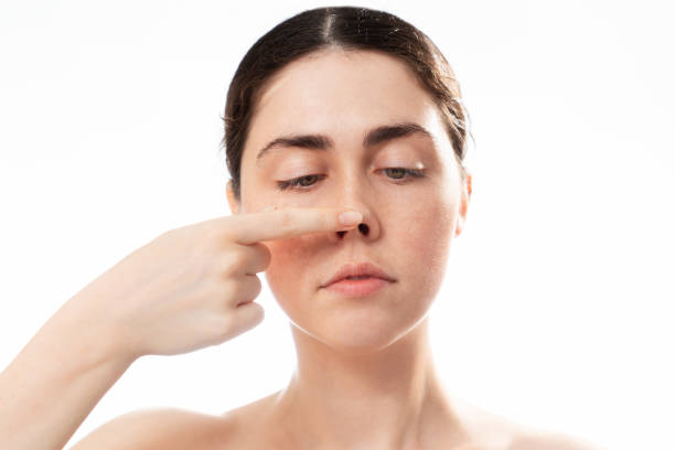 Can Closed Rhinoplasty Improve Your Side Profile