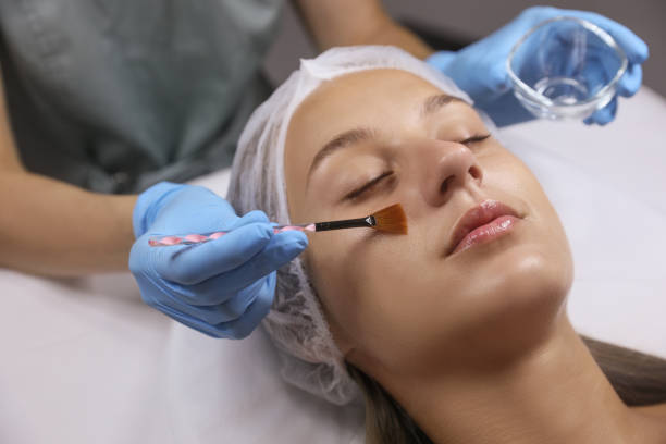 Can Inno Peel Treatment Help With Tired-Looking Skin