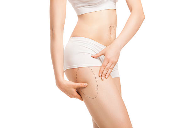 Can Lower Body Lift Improve Sagging Skin Around the Hips