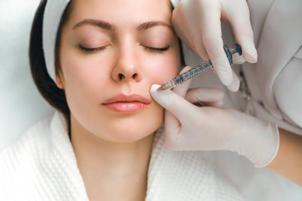 Can Russian Lip Fillers Define a Less Visible Cupid’s Bow