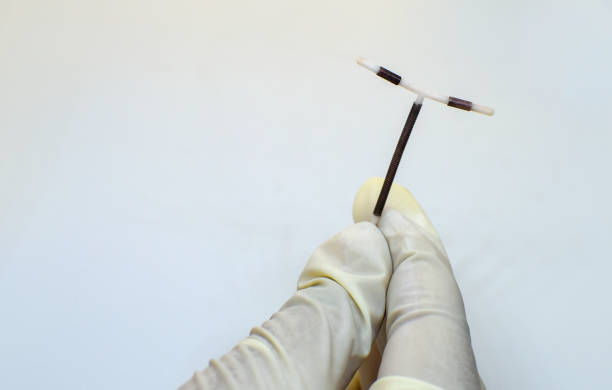 Does Copper T Need Routine Replacement or Checkups