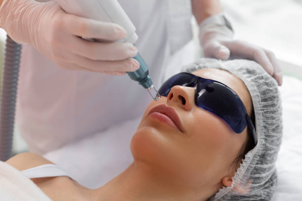 How Does Pico Laser Treatment Improve Skin Brightness
