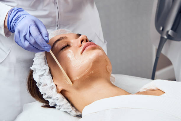How often should you consider Chemical Peels for your skin