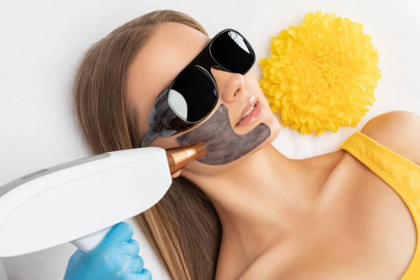 Is Laser Carbon Peel suitable for different skin types