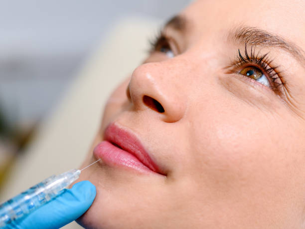 Is Lip Fillers Treatment Ideal for Thin or Uneven Lips