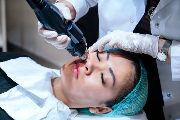 Is Pico Laser Treatment suitable for sensitive skin