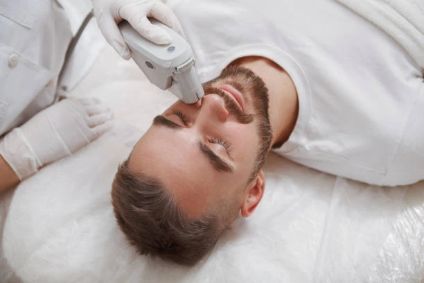 What Can Beard Laser Hair Removal Do for Beard Growth?