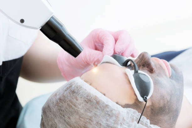 What Can Laser Carbon Peel Do for Oily Skin