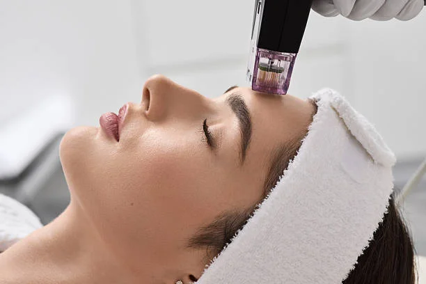What Does Microneedling Treatment Do for Skin
