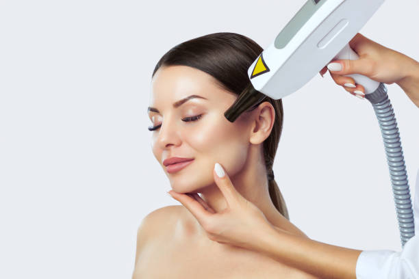 What Makes Laser Carbon Peel Popular for Skin