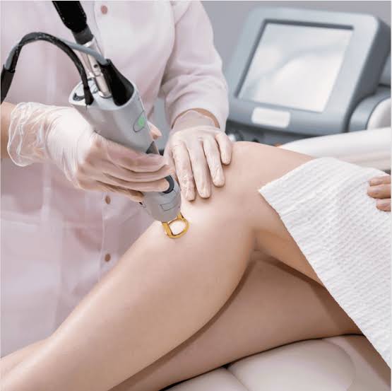 What Makes Laser Hair Removal Popular Today?