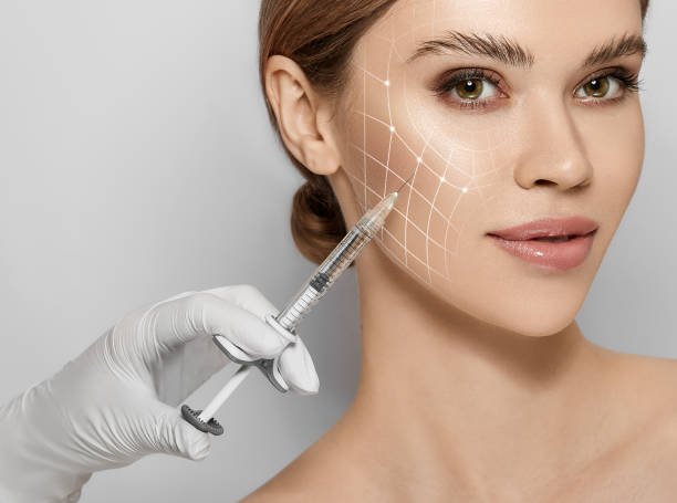 What results can you expect from Cheek Fillers treatment