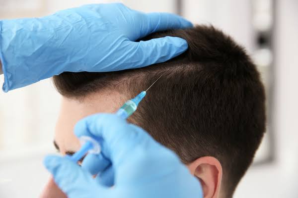 What should you know before choosing FUE Hair Transplant