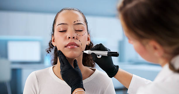 What should you know before considering a Facelift procedure